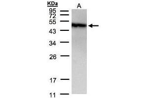 WB Image Sample(30 μg of whole cell lysate) A:A431, 12% SDS PAGE antibody diluted at 1:1500 (GOPC antibody  (C-Term))