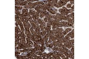 Immunohistochemical staining of human liver with ATHL1 polyclonal antibody  shows strong cytoplasmic positivity in hepatocytes at 1:20-1:50 dilution. (ATHL1 antibody)