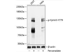 Western blot analysis of extracts of 293T and Hela cells, using Phospho-Eph-Y779 antibody (ABIN6135216, ABIN6136068, ABIN6136069 and ABIN6225663) at 1:2000 dilution. (EPH Receptor A3 antibody  (pTyr779))