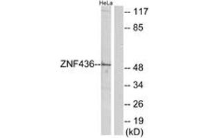 Western blot analysis of extracts from HeLa cells, using ZNF436 Antibody. (ZNF436 antibody  (AA 71-120))
