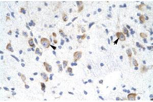 Rabbit Anti-GTF2F2 Antibody Catalog Number: ARP31437 Paraffin Embedded Tissue: Human Brain Cellular Data: Neural Cells Antibody Concentration: 4. (GTF2F2 antibody  (Middle Region))