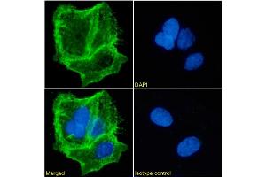 Immunofluorescence staining of Caco-2 cells using anti-EpCAM. (Recombinant EpCAM antibody)