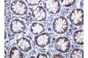 Image no. 2 for anti-Mast/stem Cell Growth Factor Receptor (KIT) (AA 546-976) antibody (ABIN1491586) (KIT antibody  (AA 546-976))