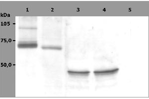 Western Blotting analysis (non-reducing conditions) of whole cell lysate of RAMOS human Burkitt lymphoma cell line (1), RBL rat basophilic leukemia cell line (2) and HeLa human cervix carcinoma cell line (3, 4). (SYK antibody  (AA 5-360))