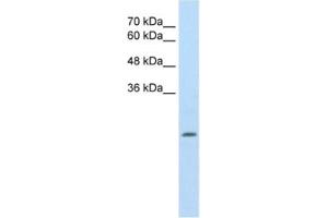 Western Blotting (WB) image for anti-Aldehyde Dehydrogenase 4 Family, Member A1 (ALDH4A1) antibody (ABIN2462883) (ALDH4A1 antibody)