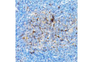 Immunohistochemistry of paraffin-embedded mouse spleen using SI antibody (ABIN3016131, ABIN3016132, ABIN3016133 and ABIN6219568) at dilution of 1:100 (40x lens). (SIAH1 antibody  (AA 1-313))