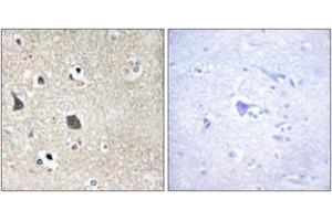 Immunohistochemistry analysis of paraffin-embedded human brain tissue, using TRI18 Antibody. (MID1 antibody  (AA 71-120))