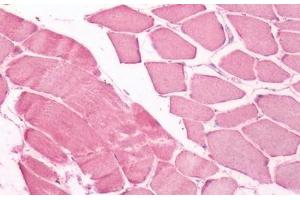 Human Skeletal Muscle: Formalin-Fixed, Paraffin-Embedded (FFPE) (UCHL3 antibody  (Internal Region))