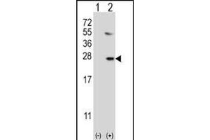 Western blot analysis of UBE2G1 (arrow) using rabbit polyclonal UBE2G1 Antibody (R11) (ABIN388859 and ABIN2839161). (UBE2G1 antibody  (N-Term))