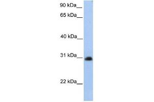 CHST14 antibody used at 1 ug/ml to detect target protein.