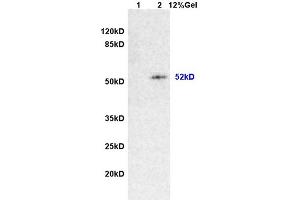 L1 rat brain lysates L2 rat intestine lysates probed with Anti Desmin/DES Polyclonal Antibody, Unconjugated (ABIN736566) at 1:200 overnight at 4 °C. (Desmin antibody  (AA 261-360))