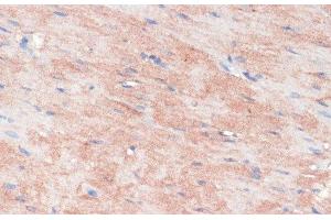 Immunohistochemistry of paraffin-embedded Rat heart using RPIA Polyclonal Antibody at dilution of 1:100 (40x lens). (Ribose 5-Phosphate Isomerase A (RPIA) antibody)