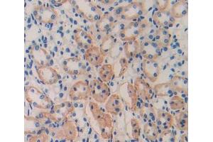 #VALUE! (CISH antibody  (AA 79-256))