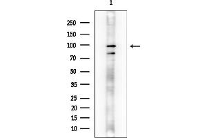 anti-Inositol-Trisphosphate 3-Kinase C (ITPKC) (N-Term) antibody
