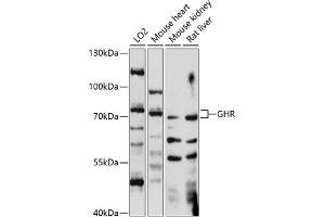 Western blot analysis of extracts of various cell lines, using GHR antibody (ABIN7267519) at 1:1000 dilution. (Growth Hormone Receptor antibody  (AA 26-260))