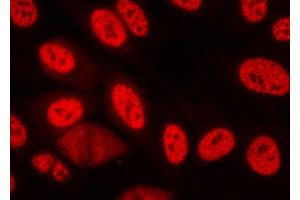 ABIN6267073 staining lovo cells by ICC/IF. (CHEK1 antibody  (pSer280))
