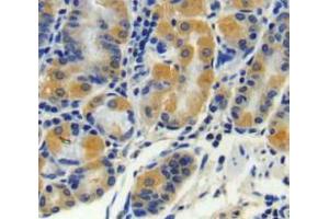 Used in DAB staining on fromalin fixed paraffin-embedded stomach tissue (CPN2 antibody  (AA 249-540))