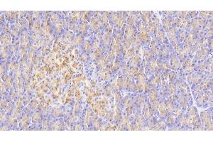 Detection of ELA3A in Human Pancreas Tissue using Polyclonal Antibody to Elastase 3A (ELA3A) (Elastase 3A antibody  (AA 16-270))