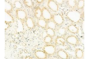 ABIN6263465 and ABIN6279559 at 1/100 staining human normal kidney tissue by IHC-P.