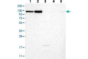 Western blot analysis of Lane 1: RT-4, Lane 2: U-251 MG, Lane 3: Human Plasma, Lane 4: Liver, Lane 5: Tonsil with NEO1 polyclonal antibody  at 1:250-1:500 dilution. (NEO1 antibody)