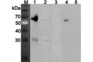 Western blot analysis using anti-ANGPTL3 (mouse), pAb  at 1:2'000 dilution. (ANGPTL3 antibody)