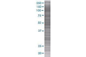 Western Blotting (WB) image for IL25 293T Cell Transient Overexpression Lysate(Denatured) (ABIN1337528)