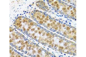 Immunohistochemistry of paraffin-embedded Human colon using GOT1 Polyclonal Antibody at dilution of 1:100 (40x lens). (GOT1 antibody)