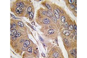 Immunohistochemistry (IHC) image for anti-Ribosomal Protein S6 Kinase, 70kDa, Polypeptide 1 (RPS6KB1) (AA 425-454) antibody (ABIN3032481)