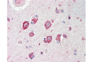 Anti-CACNG8 antibody IHC staining of human brain, cortex. (CACNG8 antibody  (AA 90-119))