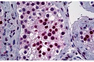 Human, Testis: Formalin-Fixed Paraffin-Embedded (FFPE) (YY1 antibody  (AA 221-321))