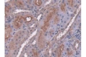 Detection of AT in Rat Kidney Tissue using Polyclonal Antibody to Antithrombin (AT) (SERPINC1 antibody  (AA 33-465))