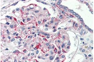 Human Kidney (formalin-fixed, paraffin-embedded) stained with JAG1 antibody ABIN337168 at 5 ug/ml followed by biotinylated goat anti-rabbit IgG secondary antibody ABIN481713, alkaline phosphatase-streptavidin and chromogen. (JAG1 antibody  (AA 110-125))