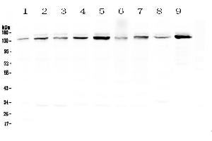 Western blot analysis of HAUSP/USP7 using anti-HAUSP/USP7 antibody . (USP7 antibody  (AA 258-483))
