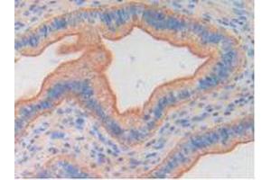 Figure. (FGF6 antibody  (AA 39-208))