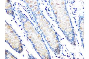 Immunohistochemistry of paraffin-embedded human colon using MUC2 Rabbit mAb (ABIN7268689) at dilution of 1:100 (40x lens). (MUC2 antibody)