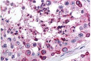 Immunohistochemistry (IHC) image for anti-Apolipoprotein B mRNA Editing Enzyme, Catalytic Polypeptide-Like 3G (APOBEC3G) (AA 51-100) antibody (ABIN6736355)