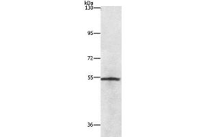 Western Blot analysis of Lovo cell using NEK2 Polyclonal Antibody at dilution of 1:727 (NEK2 antibody)