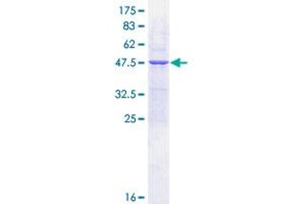 UBE2E1 Protein (AA 1-193) (GST tag)