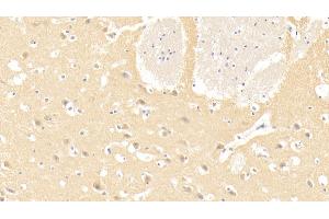 Detection of LAMa3 in Human Cerebrum Tissue using Monoclonal Antibody to Laminin Alpha 3 (LAMa3) (LAMA3 antibody  (AA 47-296))