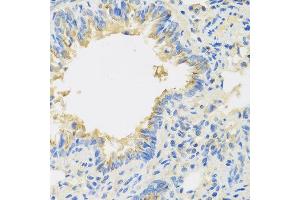 Immunohistochemistry of paraffin-embedded mouse lung using IL22 antibody at dilution of 1:100 (40x lens). (IL-22 antibody)