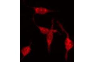 ABIN6273889 staining Hela by IF/ICC. (GPR68 antibody  (Internal Region))
