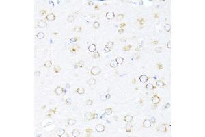 Immunohistochemistry of paraffin-embedded rat brain using DN antibody (ABIN6127810, ABIN6139703, ABIN6139704 and ABIN6216724) at dilution of 1:100 (40x lens). (DNAJB11 antibody  (AA 89-358))