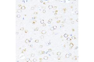 Immunohistochemistry of paraffin-embedded rat brain using DN antibody (ABIN6127810, ABIN6139703, ABIN6139704 and ABIN6216724) at dilution of 1:100 (40x lens).