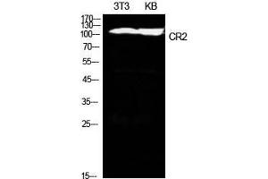 Western Blot (WB) analysis of NIH-3T3, KB cells using CD21 Polyclonal Antibody.