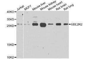 Western blot analysis of extracts of various cell lines, using UBE2R2 antibody. (UBE2R2 antibody  (AA 1-238))