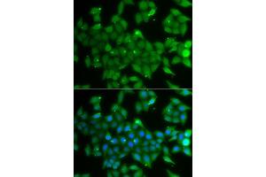 Immunofluorescence analysis of A549 cells using ANXA11 antibody. (Annexin A11 antibody  (AA 276-505))