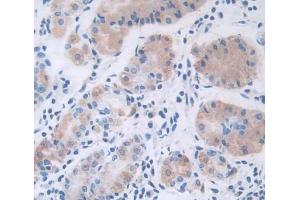 Used in DAB staining on fromalin fixed paraffin- embedded stomach tissue (Leptin antibody  (AA 22-167))