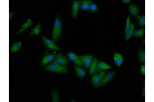 Immunofluorescence staining of Hela cells with ABIN7145566 at 1:200, counter-stained with DAPI. (EPRS antibody  (AA 1207-1399))