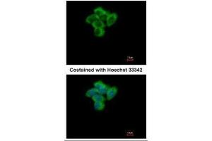ICC/IF Image Immunofluorescence analysis of paraformaldehyde-fixed A431, using SENP2, antibody at 1:500 dilution.