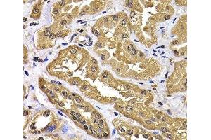 Immunohistochemistry of paraffin-embedded Human kidney using WBSCR22 Polyclonal Antibody at dilution of 1:100 (40x lens). (WBSCR22 antibody)